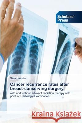 Cancer recurrence rates after breast-conserving surgery Hassani, Sara 9786209031342 Scholars' Press - książka