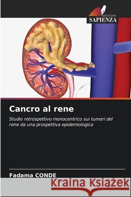 Cancro al rene CONDE, Fadama 9786202002981 Edizioni Sapienza - książka