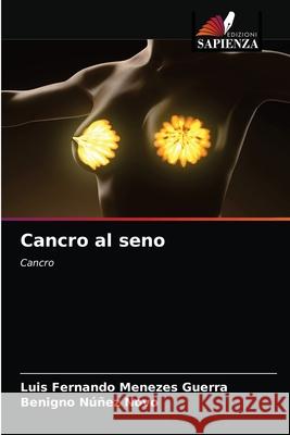 Cancro al seno Luis Fernando Menezes Guerra Benigno N 9786203482324 Edizioni Sapienza - książka