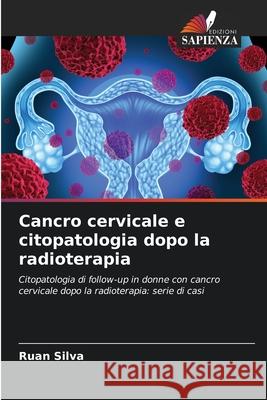 Cancro cervicale e citopatologia dopo la radioterapia Ruan Silva 9786207740970 Edizioni Sapienza - książka