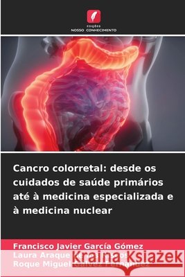 Cancro colorretal: desde os cuidados de sa?de prim?rios at? ? medicina especializada e ? medicina nuclear Francisco Javier Garc?a G?mez Laura Araque de Los Riscos Roque Miguel G?lvez Fern?ndez 9786630252545 Edicoes Nosso Conhecimento - książka