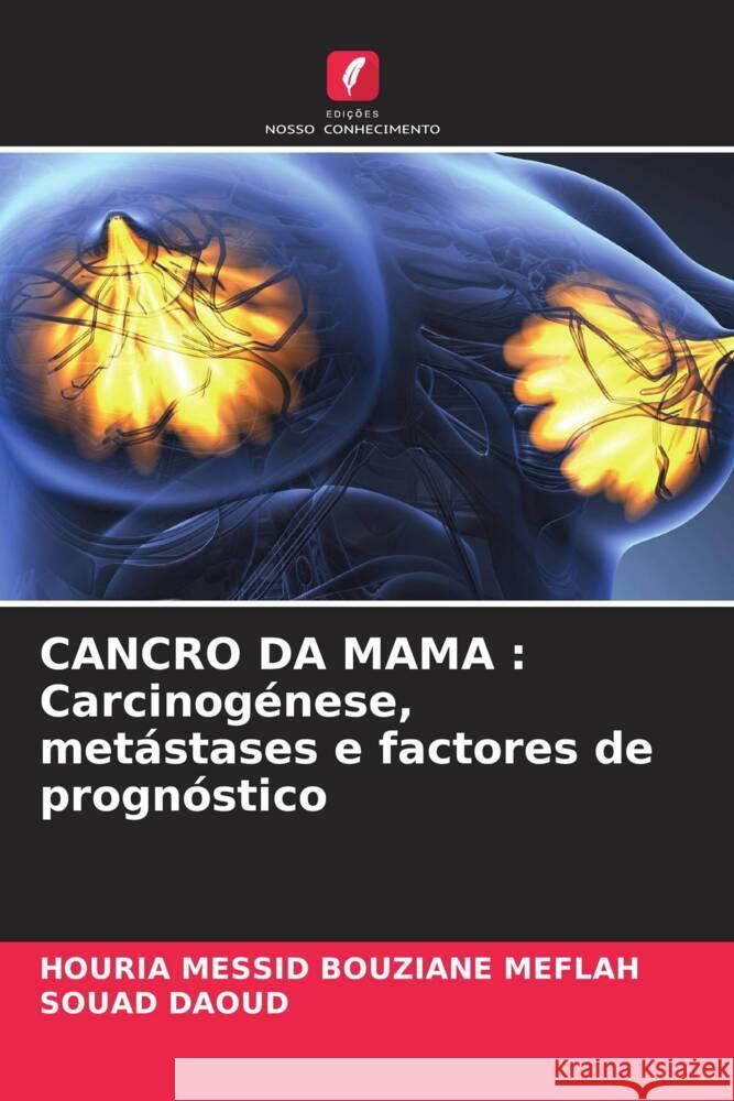 Cancro Da Mama: Carcinog?nese, met?stases e factores de progn?stico Houria Messi Souad Daoud 9786206848110 Edicoes Nosso Conhecimento - książka