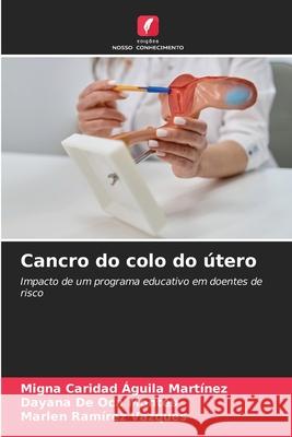Cancro do colo do útero Águila Martínez, Migna Caridad, De Oca Montes, Dayana, Ramírez Vázques, Marlen 9786208983604 Edições Nosso Conhecimento - książka