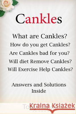 Cankles: This Guide will answer all of your Cankles questions Rehor, Tony 9781482785814 Createspace - książka
