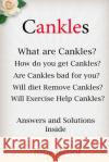 Cankles: This Guide will answer all of your Cankles questions Rehor, Tony 9781482785814 Createspace