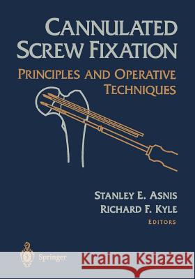 Cannulated Screw Fixation: Principles and Operative Techniques Asnis, Stanley E. 9781461275039 Springer - książka