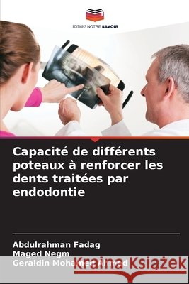 Capacité de différents poteaux à renforcer les dents traitées par endodontie Fadag, Abdulrahman, Negm, Maged, Ahmed, Geraldin Mohamed 9786209694868 Editions Notre Savoir - książka