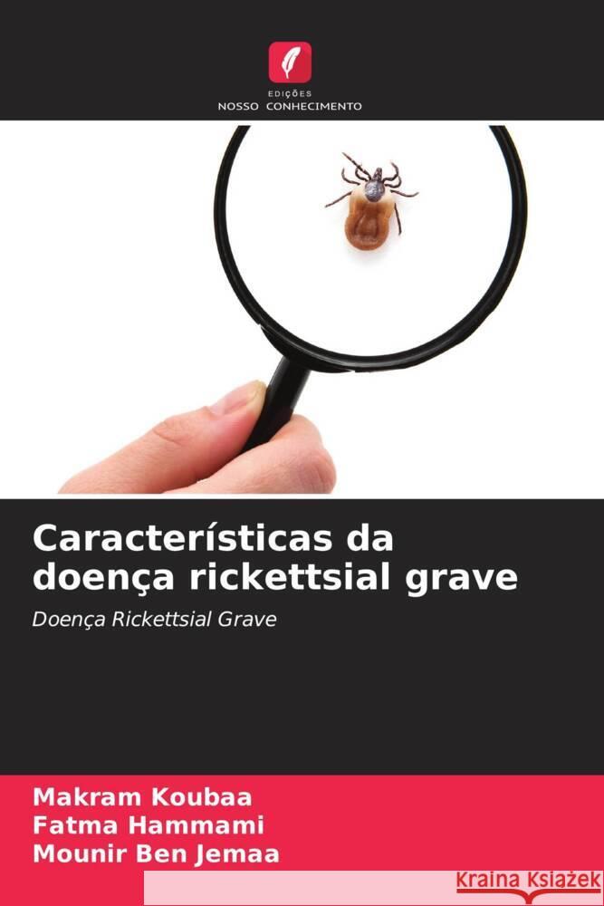 Características da doença rickettsial grave Koubaa, Makram, Hammami, Fatma, Ben Jemaa, Mounir 9786206555728 Edições Nosso Conhecimento - książka