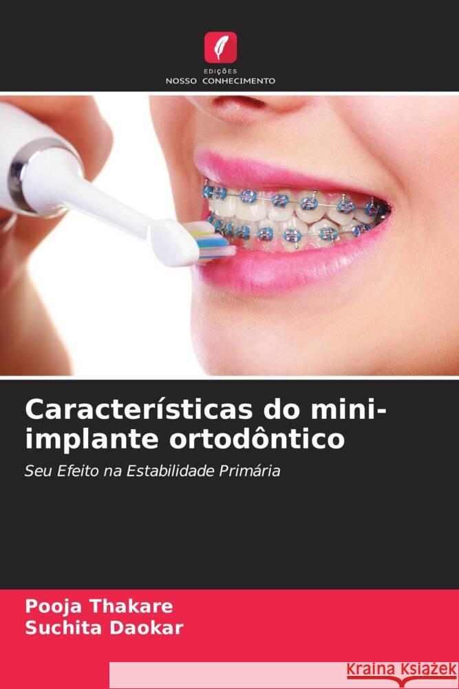 Características do mini-implante ortodôntico Thakare, Pooja, Daokar, Suchita 9786205077061 Edições Nosso Conhecimento - książka