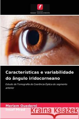 Características e variabilidade do ângulo iridocorneano Meriem Ouederni, Insaf Mrad 9786204044408 Edicoes Nosso Conhecimento - książka