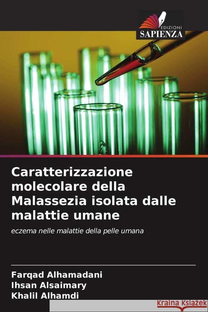 Caratterizzazione molecolare della Malassezia isolata dalle malattie umane Alhamadani, Farqad, Alsaimary, Ihsan Edan, Alhamdi, Khalil 9786204757520 Edizioni Sapienza - książka