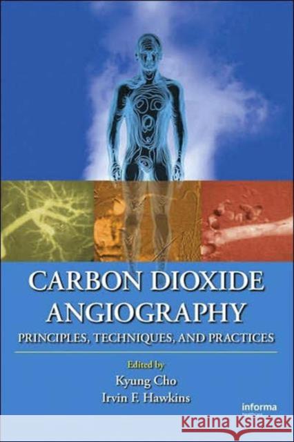 Carbon Dioxide Angiography: Principles, Techniques, and Practices Cho, Kyung 9780824728311 Informa Healthcare - książka