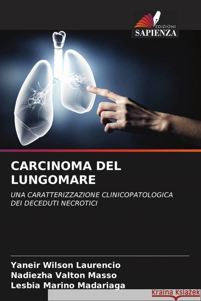 Carcinoma del Lungomare Yaneir Wilso Nadiezha Valto Lesbia Marin 9786208610197 Edizioni Sapienza - książka