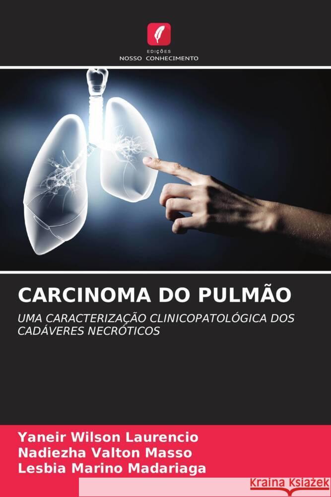 Carcinoma Do Pulm?o Yaneir Wilso Nadiezha Valto Lesbia Marin 9786208610180 Edicoes Nosso Conhecimento - książka