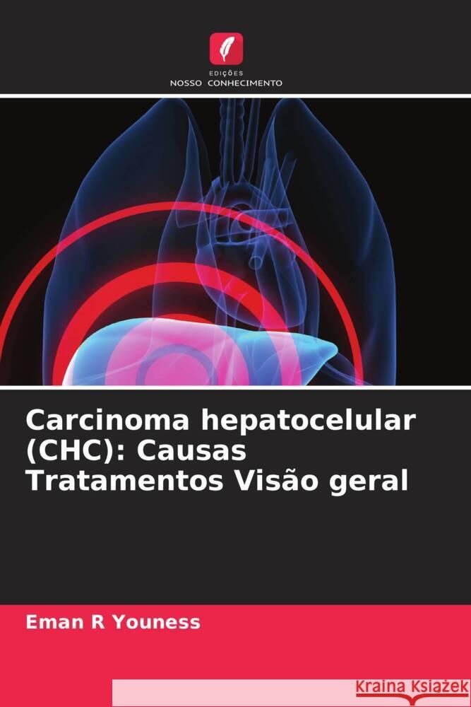 Carcinoma hepatocelular (CHC): Causas Tratamentos Visão geral Youness, Eman R 9786208341169 Edições Nosso Conhecimento - książka