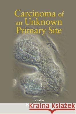 Carcinoma of an Unknown Primary Site Karim Fizazi 9780824727994 Informa Healthcare - książka