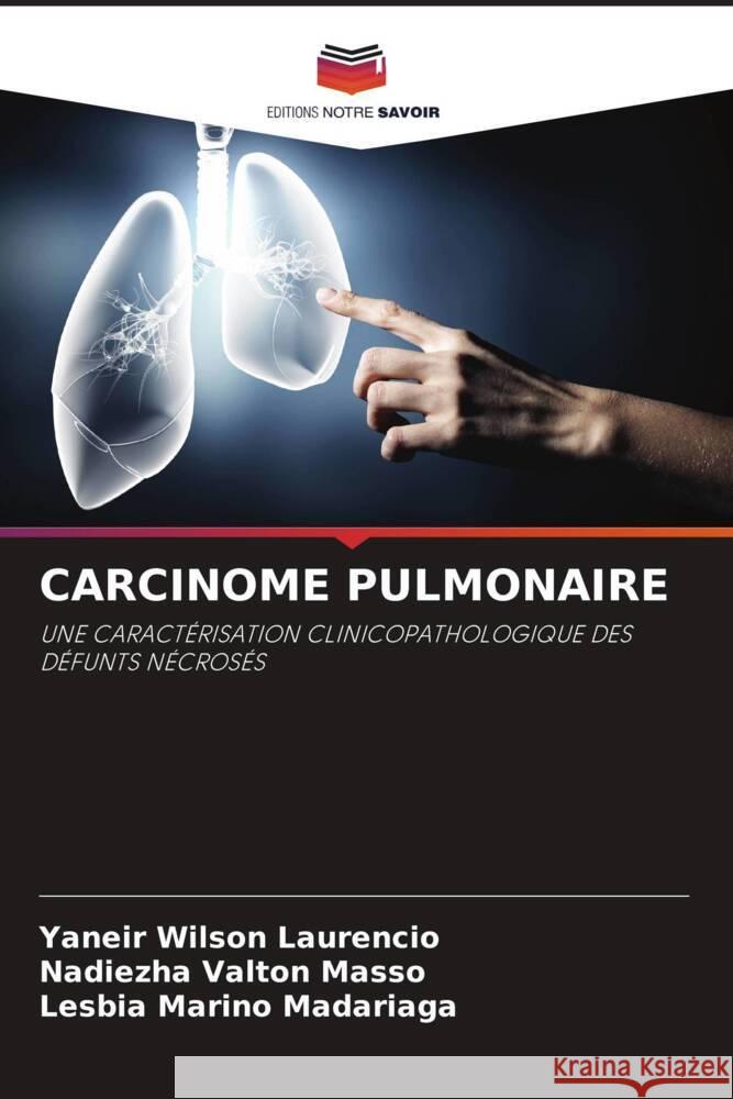 Carcinome Pulmonaire Yaneir Wilso Nadiezha Valto Lesbia Marin 9786208610203 Editions Notre Savoir - książka