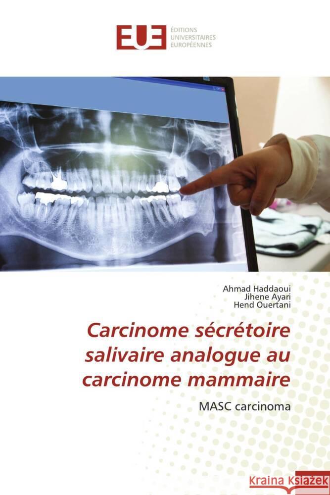 Carcinome sécrétoire salivaire analogue au carcinome mammaire Haddaoui, Ahmad, Ayari, Jihene, Ouertani, Hend 9786203443783 Éditions universitaires européennes - książka