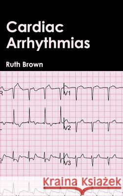 Cardiac Arrhythmias Ruth Brown 9781632410757 Hayle Medical - książka