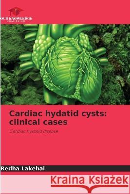 Cardiac hydatid cysts: clinical cases Redha Lakehal 9786205866702 Our Knowledge Publishing - książka
