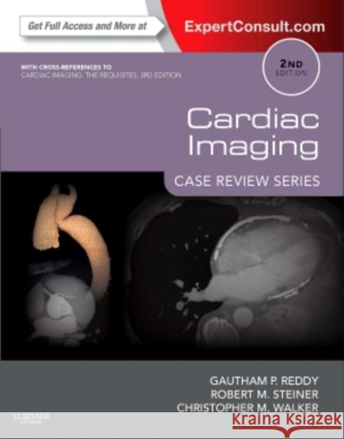 Cardiac Imaging: Case Review Series Gautham P. Reddy Robert M. Steiner Christopher Walker 9780323065191 W.B. Saunders Company - książka