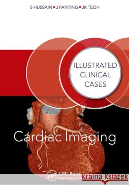 Cardiac Imaging: Illustrated Clinical Cases Hussain, Shahid 9781482235739 CRC Press - książka
