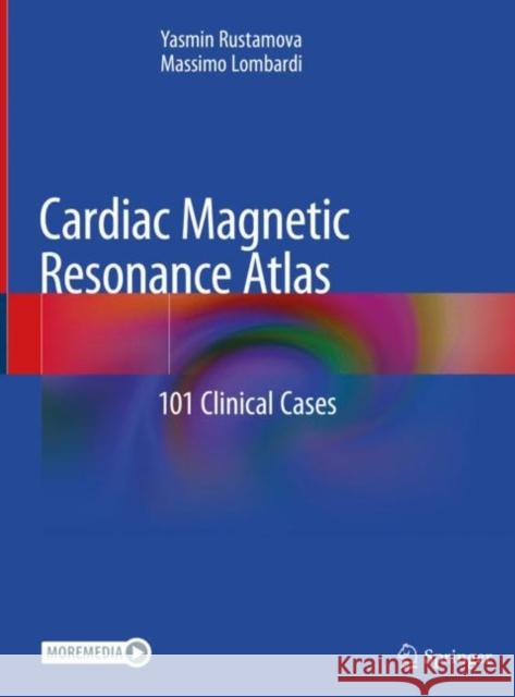 Cardiac Magnetic Resonance Atlas: 101 Clinical Cases Rustamova, Yasmin 9783030418298 Springer - książka