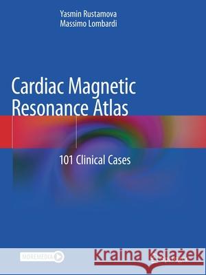 Cardiac Magnetic Resonance Atlas: 101 Clinical Cases Yasmin Rustamova Massimo Lombardi 9783030418328 Springer - książka