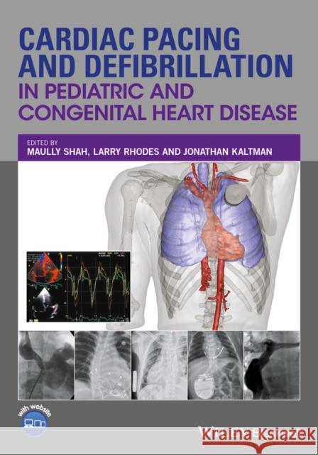 Cardiac Pacing and Defibrillation in Pediatric and Congenital Heart Disease Shah, Maully; Rhodes, Larry; Kaltman, Jonathan 9780470671092 John Wiley & Sons - książka