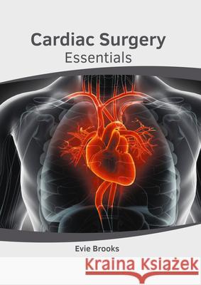 Cardiac Surgery Essentials Eve Brooks, Evie Brooks 9781632419200 Hayle Medical - książka