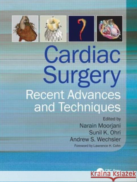 Cardiac Surgery: Recent Advances and Techniques Moorjani, Narain 9781444137569  - książka