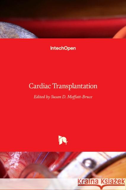 Cardiac Transplantation Susan Moffatt-Bruce 9789535100003 Intechopen - książka