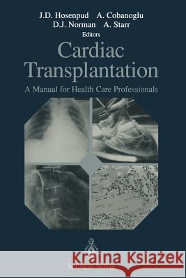 Cardiac Transplantation: A Manual for Health Care Professionals Hosenpud, Jeffrey D. 9781461277576 Springer - książka