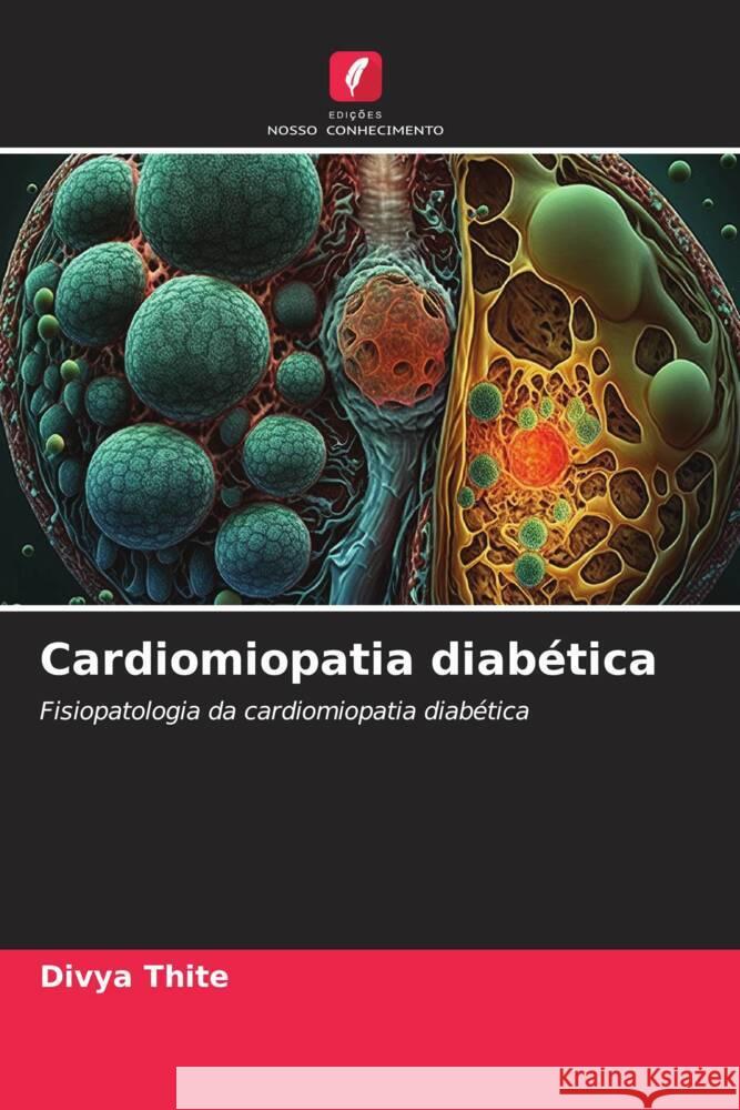 Cardiomiopatia diab?tica Divya Thite 9786207336548 Edicoes Nosso Conhecimento - książka