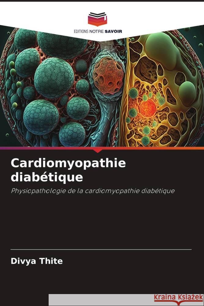 Cardiomyopathie diab?tique Divya Thite 9786207336524 Editions Notre Savoir - książka