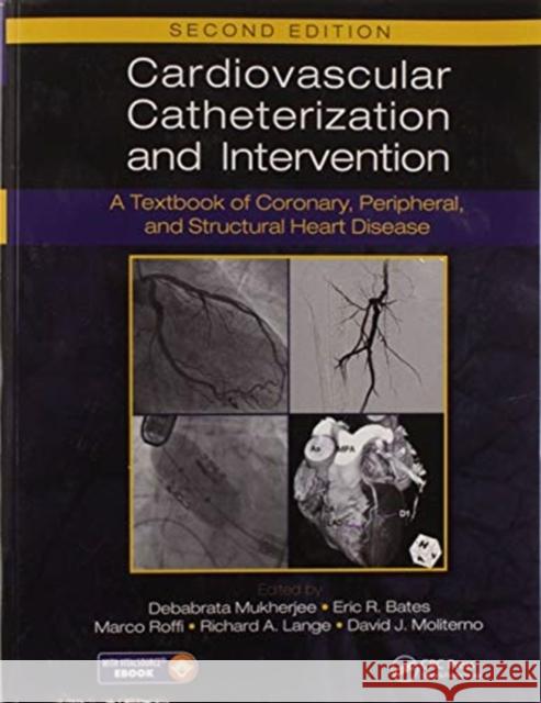 Cardiovascular Catheterization and Intervention: A Textbook of Coronary, Peripheral, and Structural Heart Disease, Second Edition Debabrata Mukherjee Eric R. Bates Marco Roffi 9780367572938 CRC Press - książka