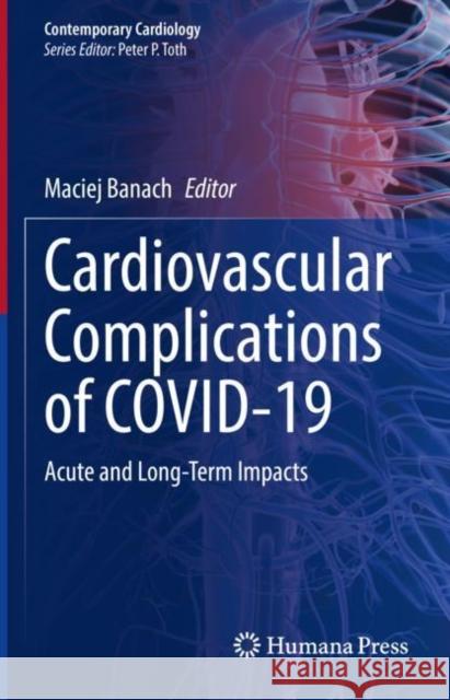 Cardiovascular Complications of COVID-19: Acute and Long-Term Impacts Maciej Banach 9783031154775 Springer - książka