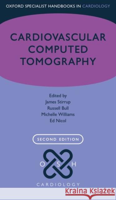 Cardiovascular Computed Tomography Stirrup, James 9780198809272 Oxford University Press, USA - książka