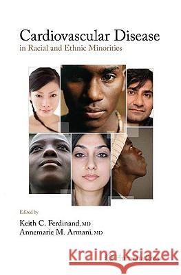 Cardiovascular Disease in Racial and Ethnic Minorities Keith Ferdinand Annemarie Armani 9781588299819 Humana Press - książka