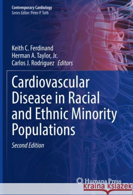 Cardiovascular Disease in Racial and Ethnic Minority Populations Keith C. Ferdinand Herman A. Taylo Carlos J. Rodriguez 9783030810337 Humana - książka