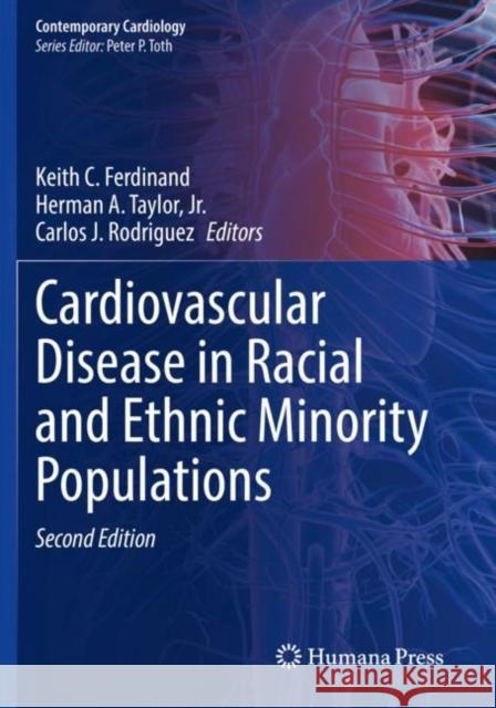 Cardiovascular Disease in Racial and Ethnic Minority Populations  9783030810368 Springer International Publishing - książka