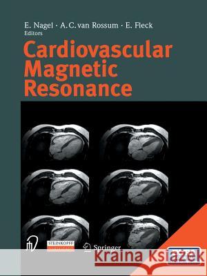 Cardiovascular Magnetic Resonance E. Nagel A. C. Van Rossum E. Fleck 9783642621529 Steinkopff-Verlag Darmstadt - książka