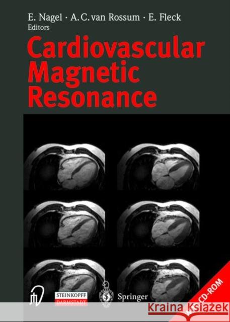 cardiovascular magnetic resonance  E. Nagel A. C. Va E. Fleck 9783798514027 Springer - książka