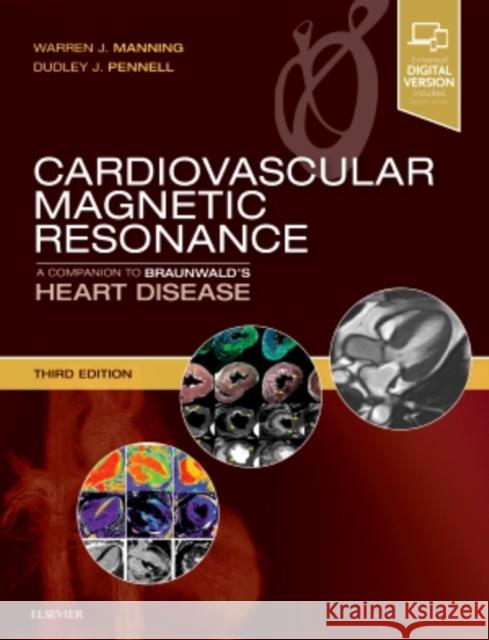 Cardiovascular Magnetic Resonance: A Companion to Braunwald's Heart Disease Manning, Warren J. 9780323415613 Elsevier - Health Sciences Division - książka