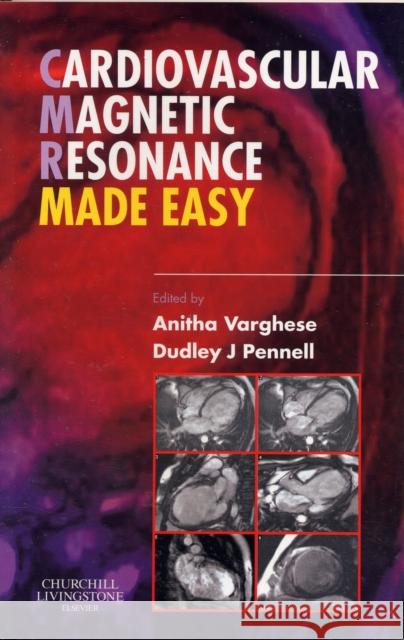 Cardiovascular Magnetic Resonance Made Easy Anitha Varghese 9780443103018  - książka