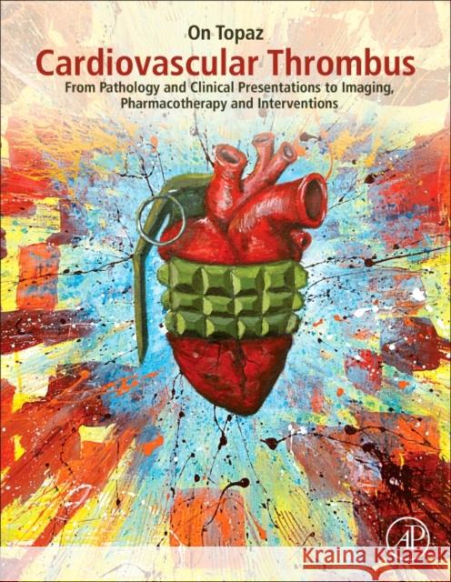 Cardiovascular Thrombus: From Pathology and Clinical Presentations to Imaging, Pharmacotherapy and Interventions On Topaz 9780128126158 Academic Press - książka