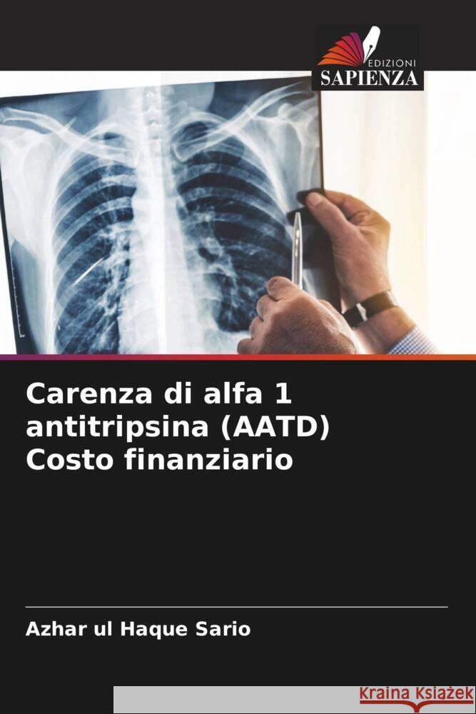 Carenza di alfa 1 antitripsina (AATD) Costo finanziario Azhar Ul Haque Sario 9786208219673 Edizioni Sapienza - książka