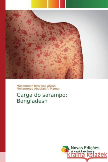 Carga do sarampo: Bangladesh Ahsan, Mohammed Rizwanul; Al Mamun, Mohammad Abdullah 9786200573353 Novas Edicioes Academicas - książka