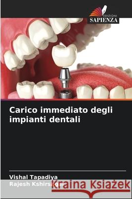 Carico immediato degli impianti dentali Vishal Tapadiya Rajesh Kshirsagar 9786207660797 Edizioni Sapienza - książka