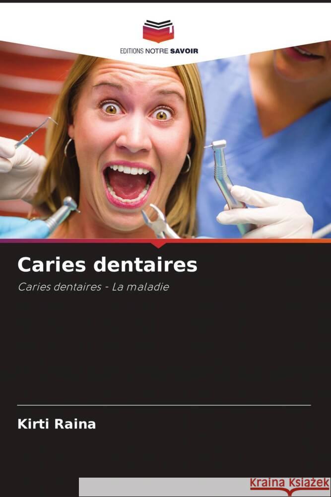 Caries dentaires Kirti Raina Anuridhi Choudhary 9786205119235 Editions Notre Savoir - książka